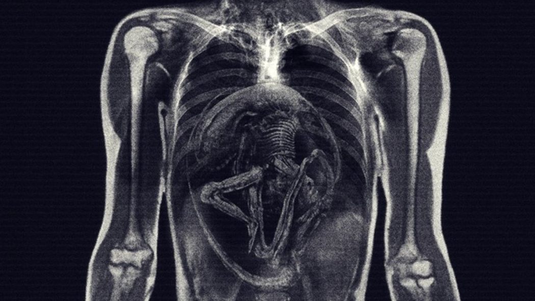 Xray Eyeballs - Xray Eyeballs Xray Eyeballs - Xray Eyeballs
